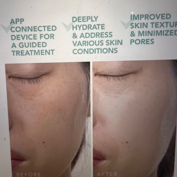 New Foreo UFO 2 and UFO Activated Masks - Picture 8 of 9